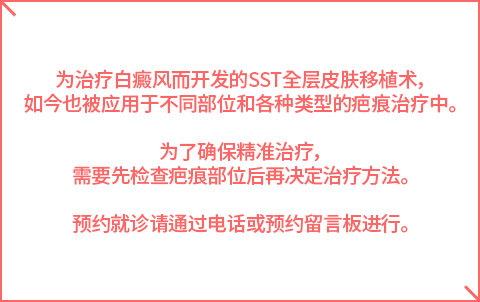 흉터치료안내