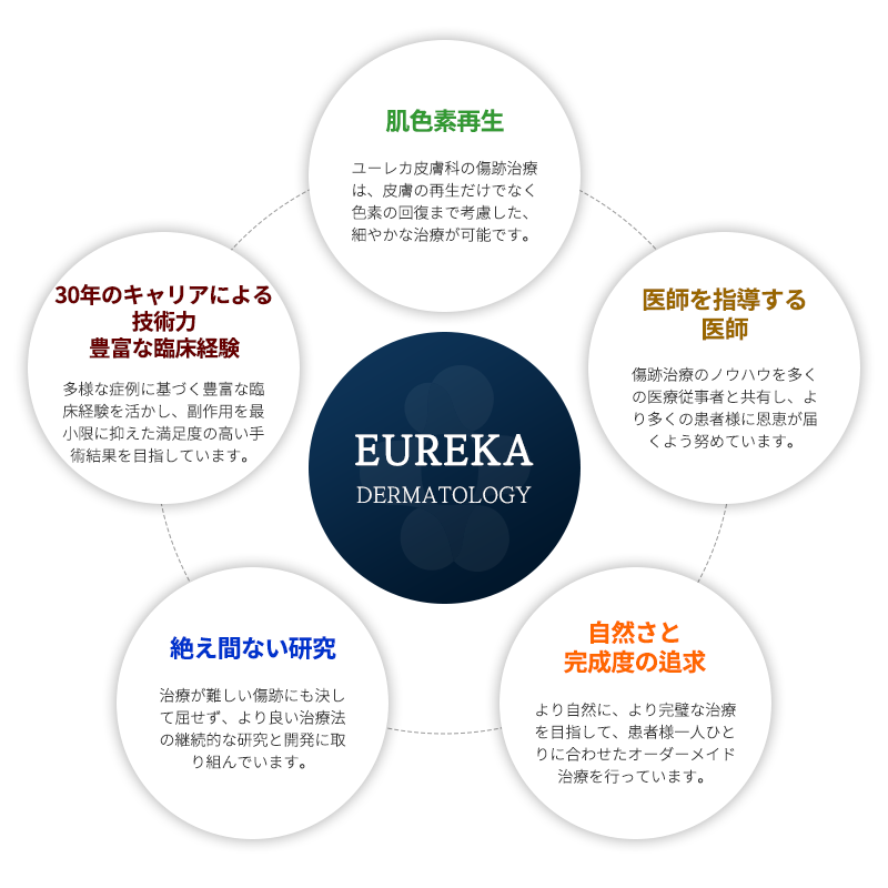 유레카 핵심포인트