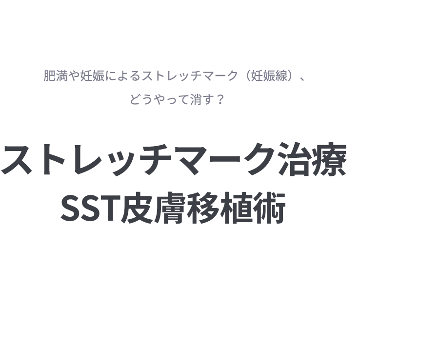 튼살치료 SST피부이식술