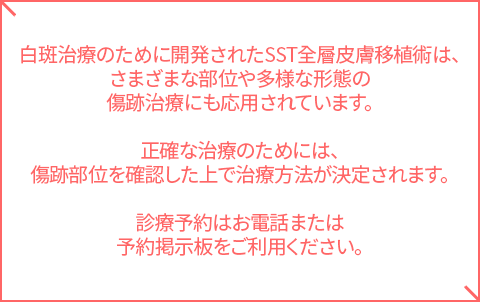흉터치료안내