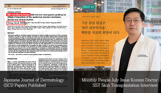 SST피부이식술