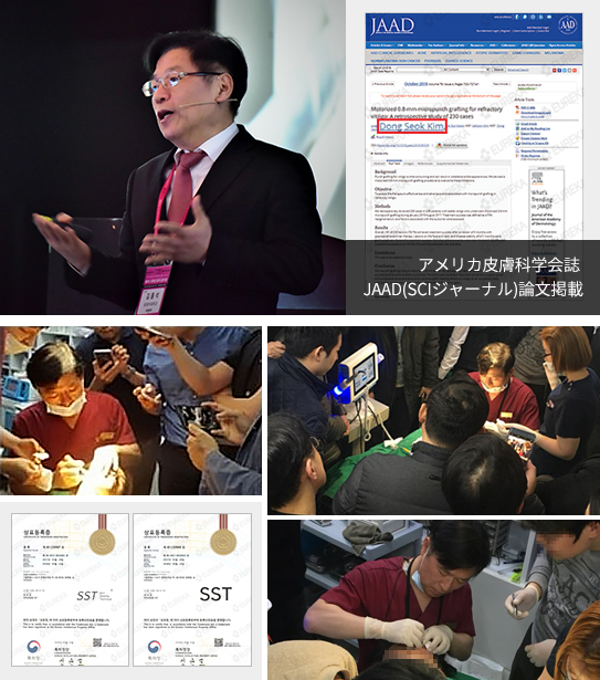 SST피부이식술