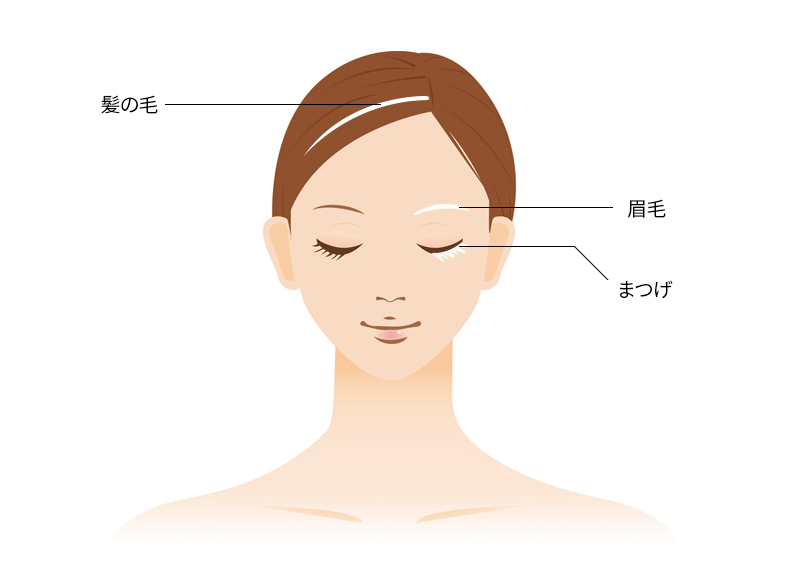유레카 백모증 모발이식 부위